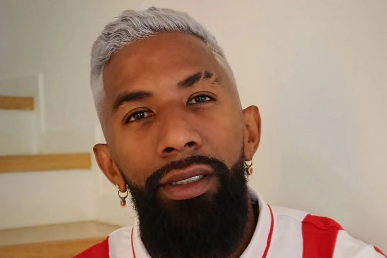 Ο Ροντινέι αποκάλυψε το νέο λουκ του – Ξύπνησα και σκέφτηκα να βάψω τα μαλλιά μου