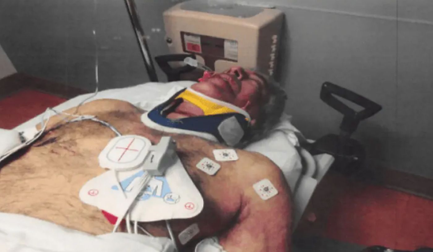 Το πρησμένο πρόσωπό του Επστάιν